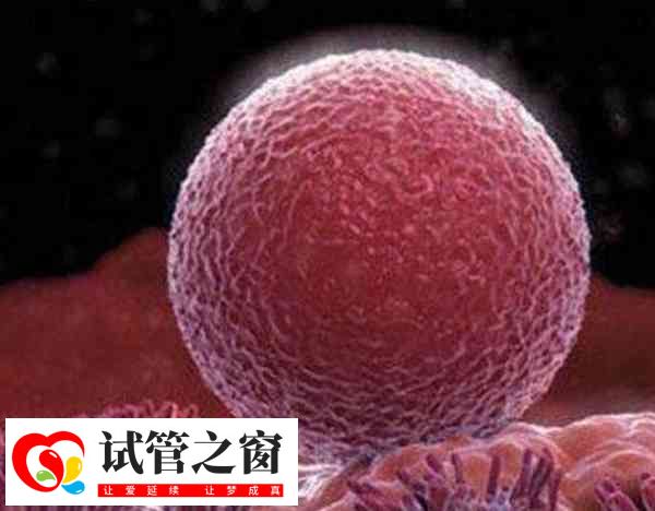 前往泰国做试管多胎妊娠的风险(图2) 泰国试管婴儿多胎妊娠容易引发早产