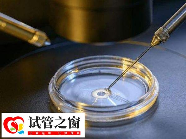 多倍体胚胎可否做三代试管移植(图2) 三代试管婴儿涉及多个环节