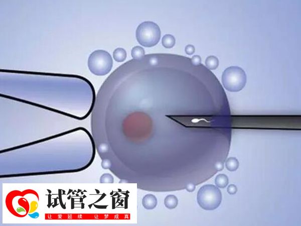 多倍体胚胎可否做三代试管移植(图3) 夫妻做三代试管能提高妊娠成功