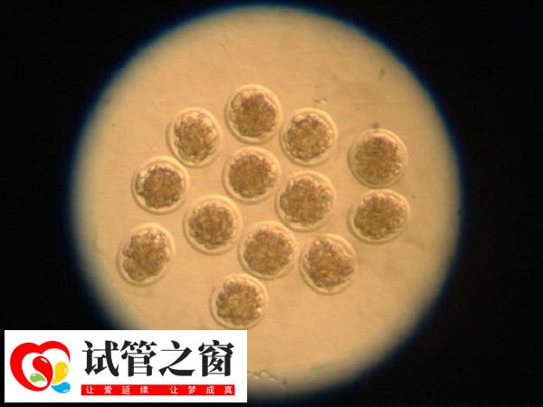 泰国试管如何看胚胎等级