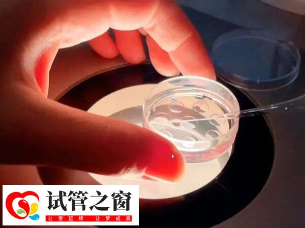4ca囊胚质量怎么样(图2) 移植4ca囊胚并不会降低成功率