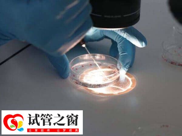 试管婴儿胚胎养囊费多少钱(图2) 养囊的具体的费用会根据医院收费标准而异