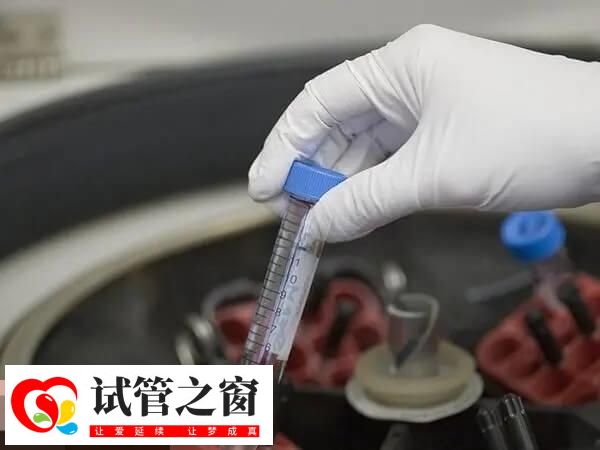 pkd1基因缺失可以生育!做好试管婴儿筛查有助优生优育(图2) PGD技术有不同的检测方法