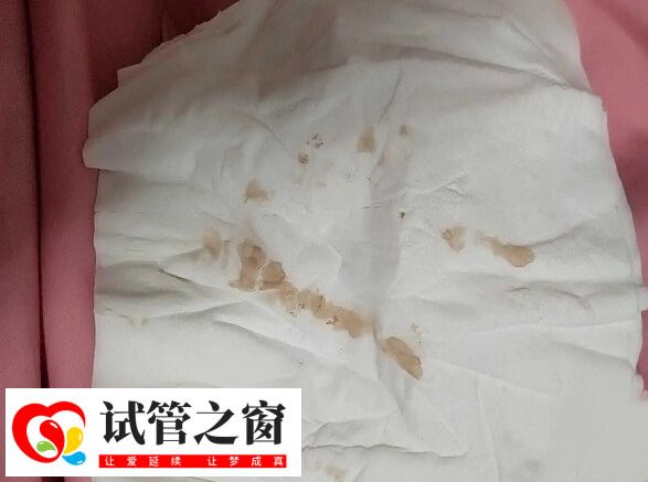 囊胚移植16天阴道出血怎么回事(图2) 囊胚移植后出血要及时就医