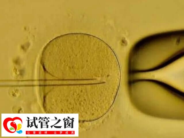 中等质量囊胚能不能移植成功(图2) 中等质量囊胚的发育能力还是不错的