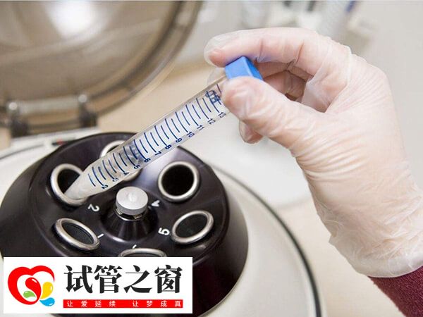取卵后多久可以移植(图2) 试管移植后的着床时间并不固定