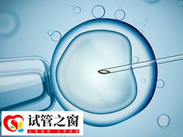 胚胎培养的操作步骤有哪些(图2) 胚胎培养时间因人而异