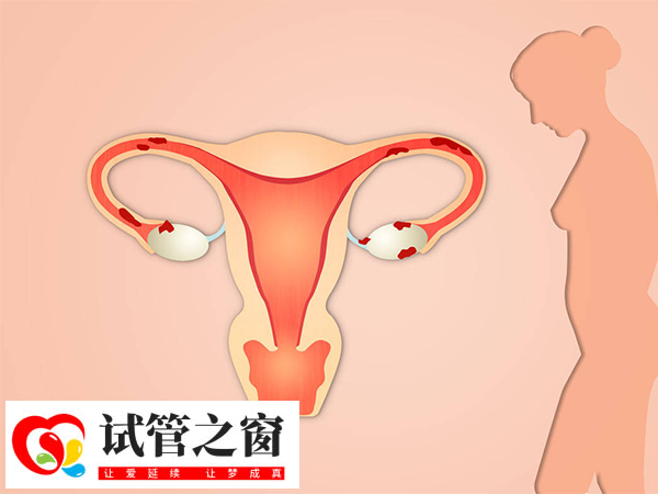 别纠结子宫内膜充血是否可以移植了，看看成功率就知道了
