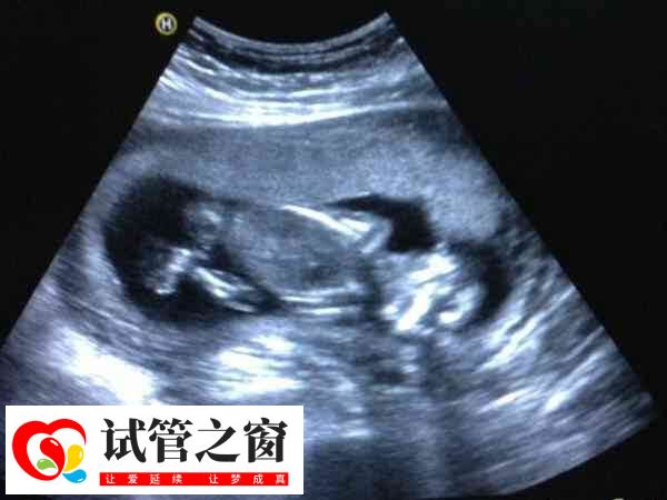 打夜针后分泌物减少是什么原因