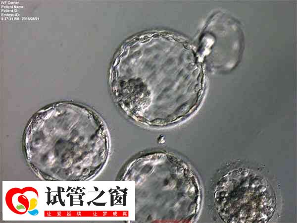 囊胚4cb质量是否比鲜胚二级好