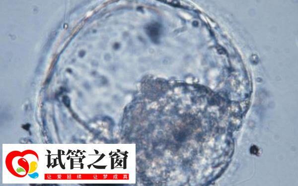 4cb囊胚确实属于等级偏低的胚胎