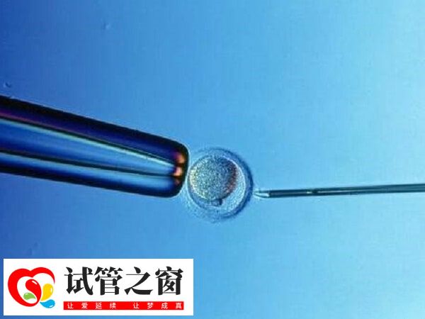 试管移植双胎着床后能不能减胎