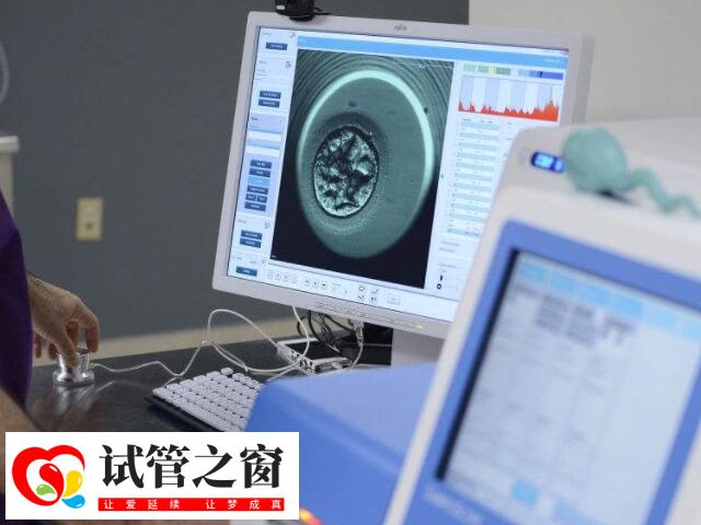 郑州试管包成功医院(图1) 试管婴儿成功率因人而异