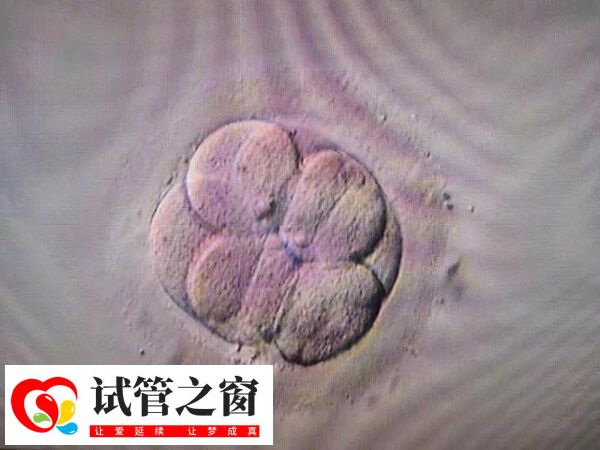 西安唐都医院试管婴儿二次移植大概多少钱?求花费明细表!(图1) 唐都医院二次移植费用多少取决于是否有冻胚