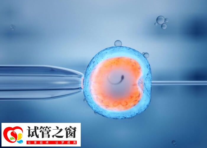 湖南中信湘雅第三代试管医生有哪些(图2) 刘黎青擅长不孕症的诊断及治疗