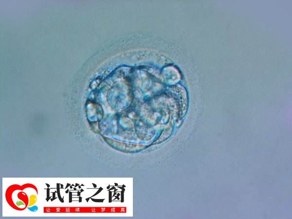 试管移植13天水印正不正常(图1) 试管移植后会出现一些症状表现