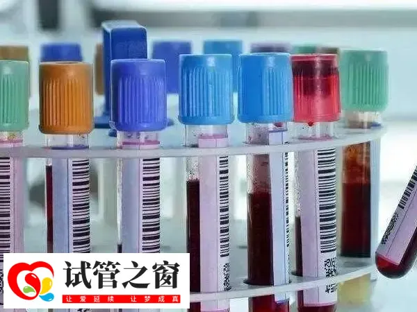 人工授精男女检查费用是多少(图2) 做试管检查性激素六项很有必要