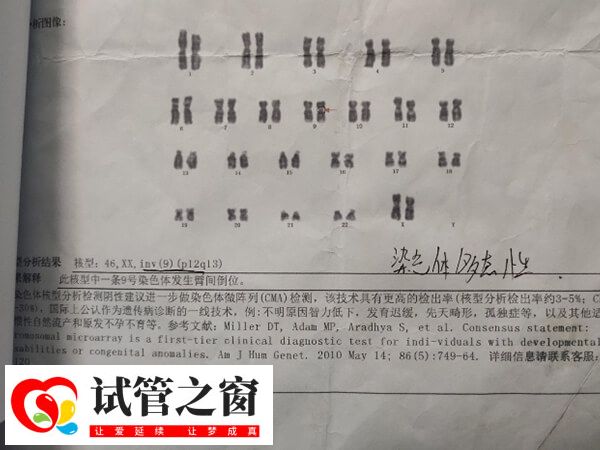 9号染色体三体严不严重(图1) 9号染色体是人类的23对染色体之一