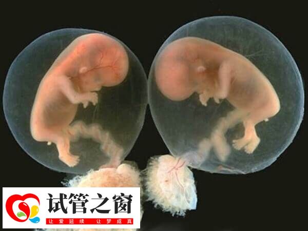 哪8种女人容易生龙凤胎(图1) 生育龙凤胎的几率并不高