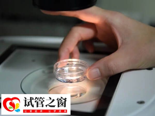 去乌克兰做试管婴儿有什么好处(图3) 乌克兰做试管不需要三证