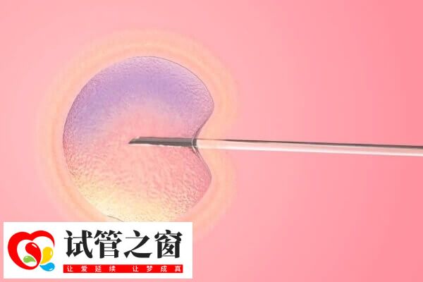 去柬埔寨做试管婴儿有哪些注意事项(图3) 柬埔寨试管成功率很高