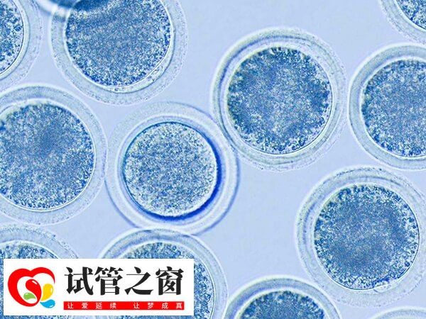 拮抗剂方案等多久移植(图1) 拮抗剂方案的移植时间因移植类型不同而有所差异
