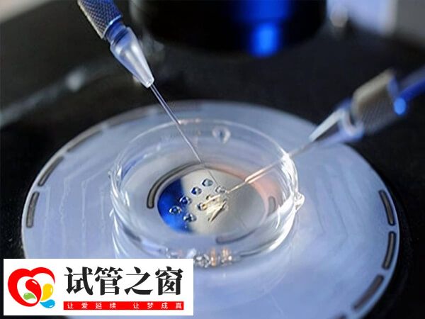 拮抗剂方案等多久移植(图2) 试管方案和试管移植的过程是不一样的