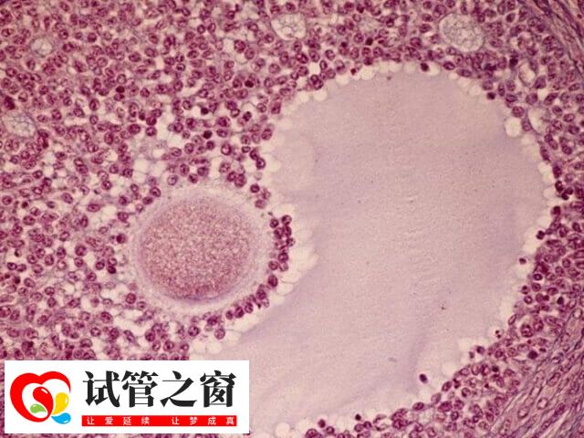 在南宁二医院做试管婴儿要提供结婚证和准生证吗?(图1) 试管婴儿也称为体外受精-胚胎移植