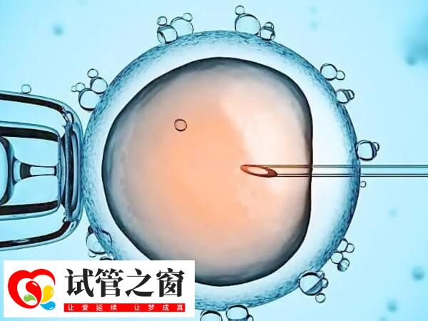 男性得红斑狼疮肾炎能不能做试管婴儿(图1) 系统性红斑狼疮能做试管婴儿