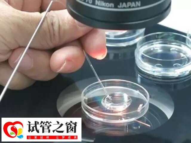 国内做第三代试管婴儿有哪些条件(图5) 国内做第三代试管的条件很严格