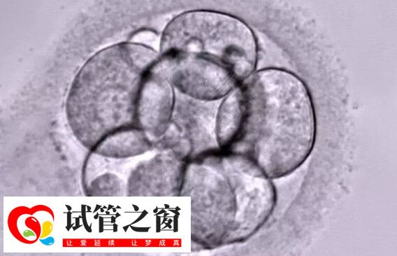 养囊从哪天开始算(图1) 试管婴儿需要在体外进行胚胎培养