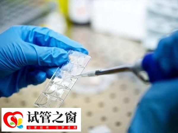 囊胚4aa好还是5bb好(图1) 囊胚4aa是一级胚胎