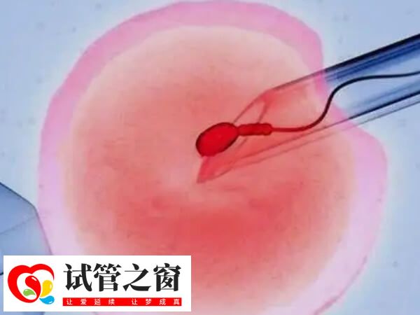 双腔取卵是不是比单腔质量差(图1) 单腔取卵针只有一个细长的管道