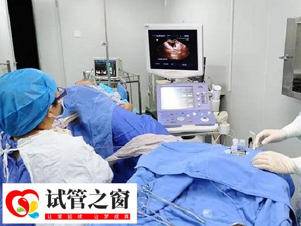 自然周期取卵前能不能同房(图1) 卵泡早排会影响取卵手术