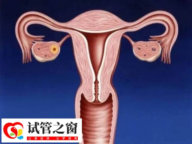 子宫内膜薄能不能做试管婴儿(图2) 子宫内膜薄做试管的成功案例不少