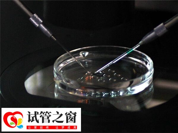 41岁高龄女性做第三代试管婴儿好吗?(图1) 高龄适合做第三代试管婴儿
