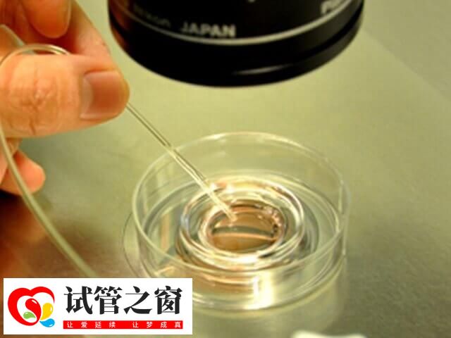 试管婴儿取卵后培养多久才能进行胚胎移植?(图1) 试管受精卵需培养3到5天成为胚胎