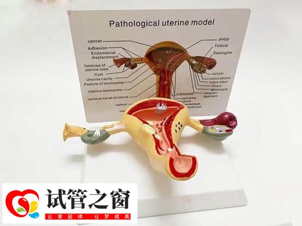 始基子宫能生育孩子吗?怎么才能提升怀孕可能性?(图1) 始基子宫是先天性发育不良