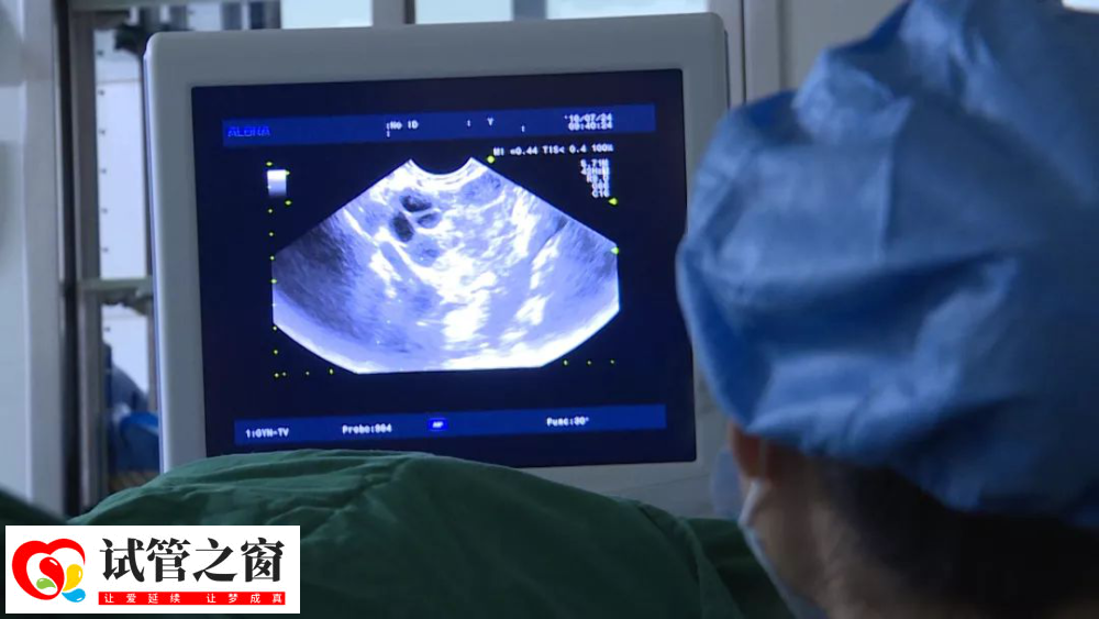 捐出儿子器官后,41岁的失独家庭挑战试管续梦(图5)