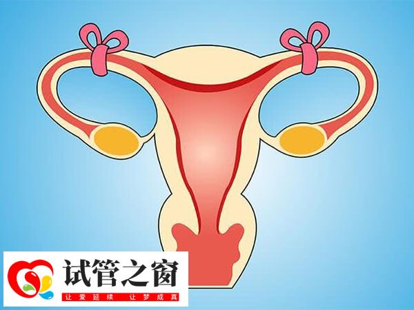 避免宫外孕是先做输卵管结扎的原因之一