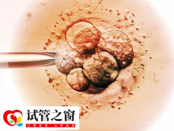 天津不同医院做试管婴儿成功率多高(图1) 天津试管婴儿技术