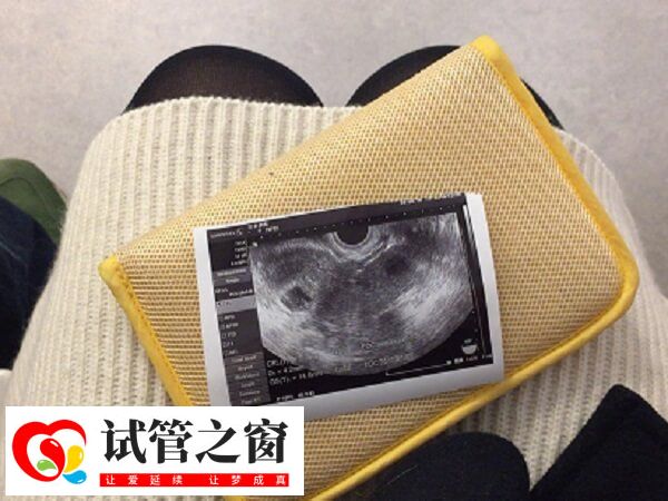 怀孕六周的时候胚胎发育很迅速了