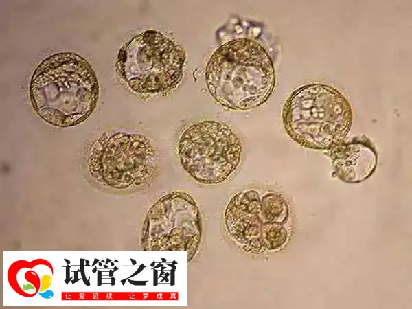 冻囊胚移植后要注意按时产检