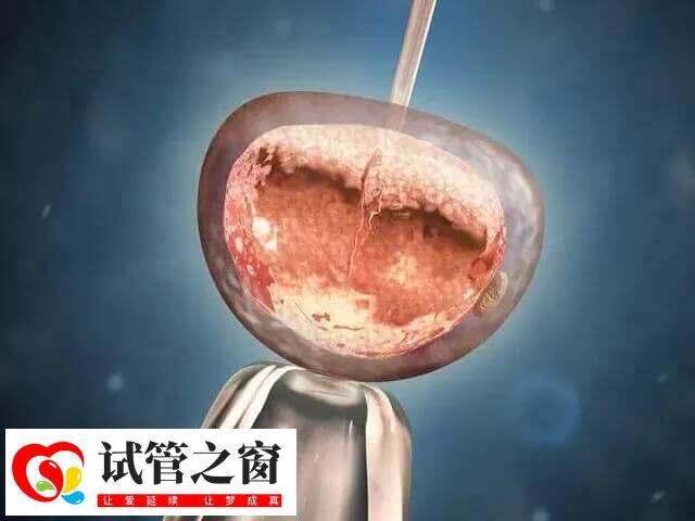 自然周期移植指在自然状态下移植
